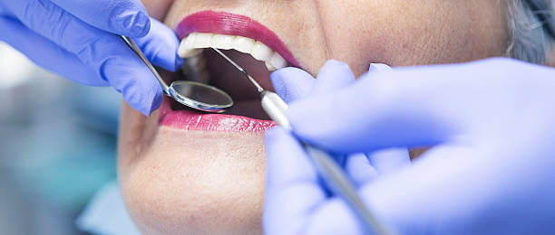 Best Knocked-Out Tooth (Avulsed Tooth) Treatment in Plymouth, CA